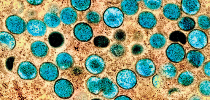 Monkeypox virus
