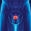 The prostate rests below the bladder. It's about the size of a walnut.