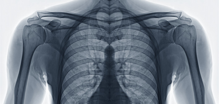 chest x ray