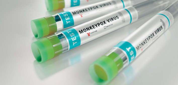 tubes monkeypox virus