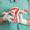 Female reproductive system