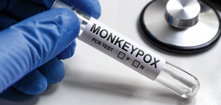 MonkeyPOX on test tube