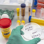 Scientific sampling of eggs in poor condition, analysis of avian influenza in humans, conceptual image