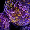 Scanning electron micrograph of HIV-1 virus particles (yellow) on human lymphocytess (purple)