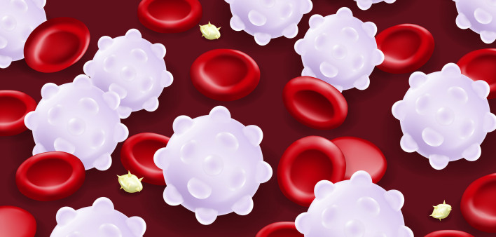Leukemia. Red blood cells, White blood cells and platelets.