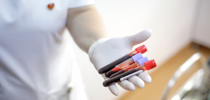 female medical worker holding blood vials after a blood donation