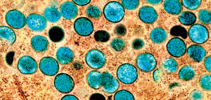 mpox virus
