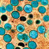 mpox virus