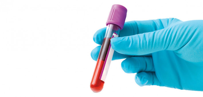 blue gloved hands holding blood vial