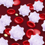 Leukemia. Red blood cells, White blood cells and platelets.