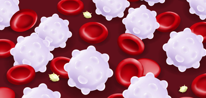 Leukemia. Red blood cells, White blood cells and platelets.