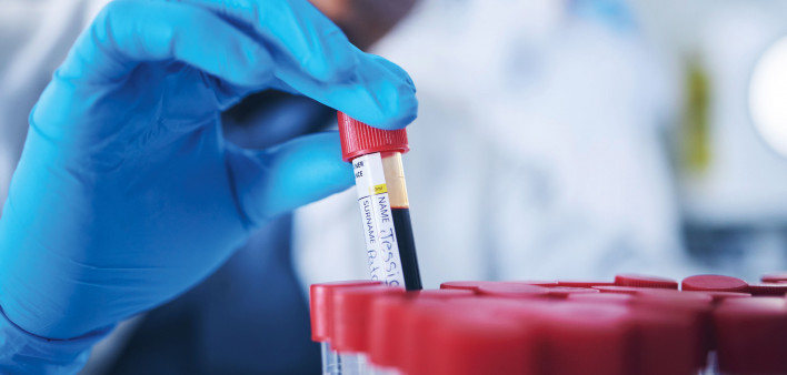 technition holding vial of blood