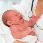 Doctor holding a newborn baby which is sick rubella or measles