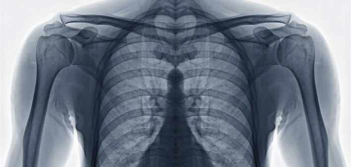 chest x ray