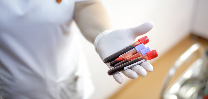 female medical worker holding blood vials after a blood donation