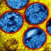 Colorized transmission electron micrograph of immature mpox virus particles (blue with red viral envelope) found within an infected VERO E6 cell (yellow), cultured in the laboratory.