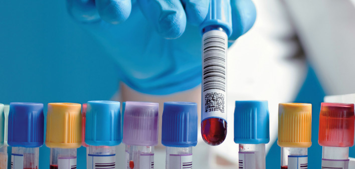 Hand drawing a blood sample tube