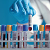 Hand drawing a blood sample tube