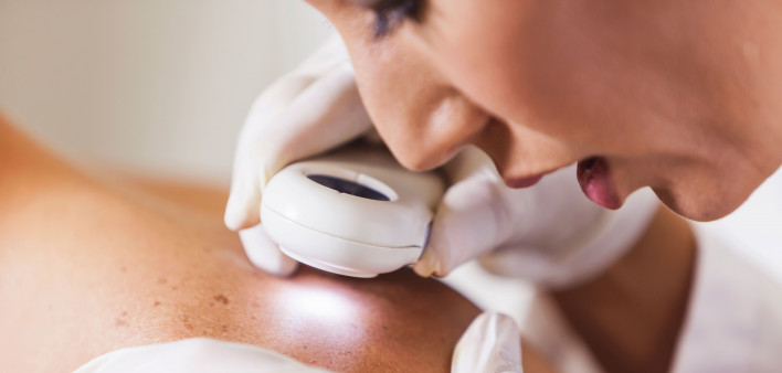 Dermatologist looking at skin with a magnifier skin cancer check
