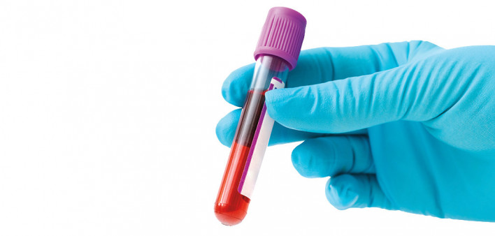 blue gloved hands holding blood vial
