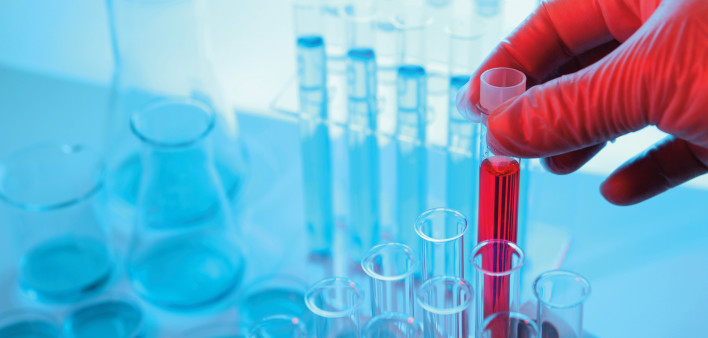 vials and beakers test tubes red liguid lab