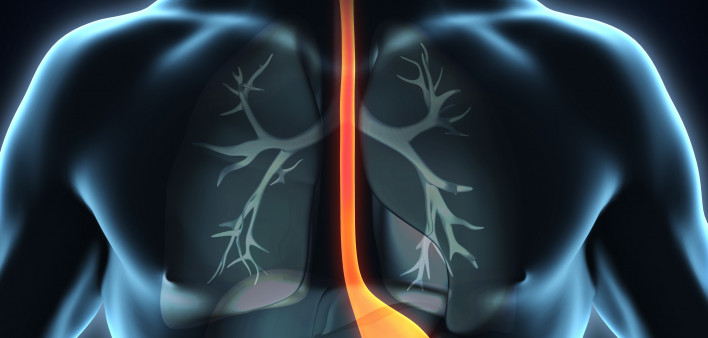 esophagus, throat, stomach, gastric, digestive tract
