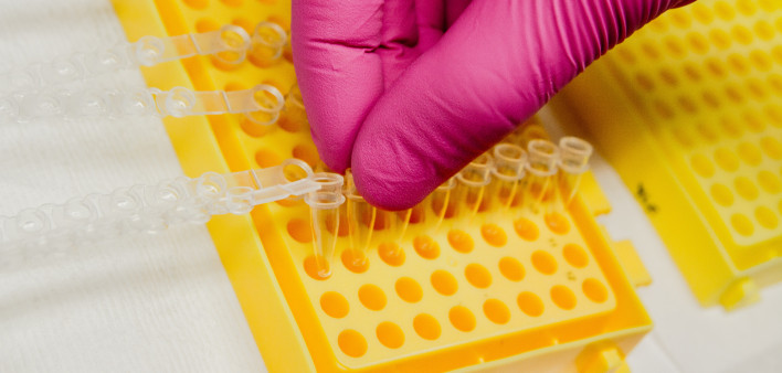 genetic testing