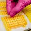 genetic testing