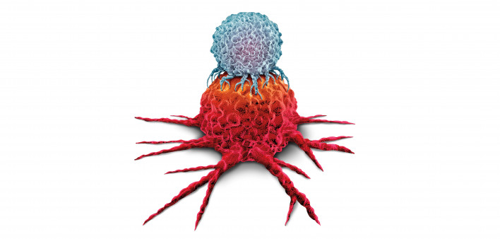 T cell attacking a cancer tumor as an Immunotherapy immune system therapy concept as a biomedical or biomedicine oncology treatment