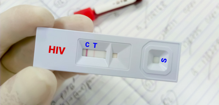 Rapid screening test for HIV (human immunodeficiency virus) screening test. Technician hold rapid test cassette,