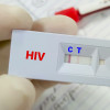 A rapid screening test for HIV