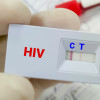A rapid screening test for HIV