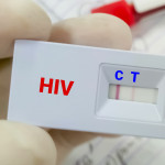 Rapid screening test for HIV (human immunodeficiency virus) screening test. Technician hold rapid test cassette,