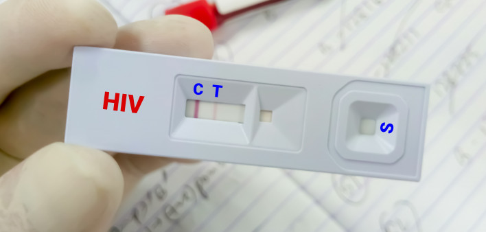 Rapid screening test for HIV (human immunodeficiency virus) screening test. Technician hold rapid test cassette,