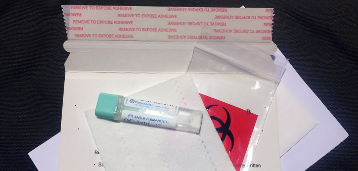 FIT test, colon cancer screening