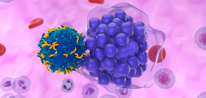 CAR T cell therapy in diffuse large B-cell lymphoma (DLBCL)