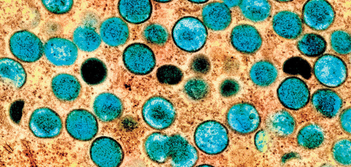 mpox virus