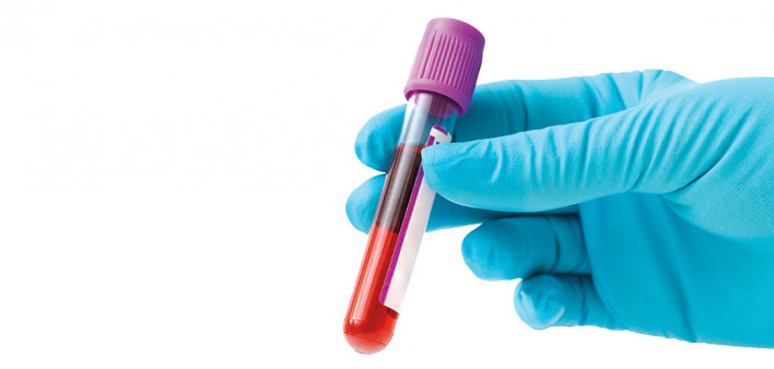 blue gloved hands holding blood vial