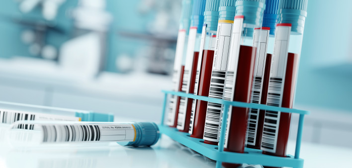 Blood Test Results In A Medical Lab stock photo Blood Test, Blood, Laboratory, Medical Test, Medical Exam