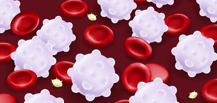 Leukemia. Red blood cells, White blood cells and platelets.