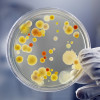 Bacteria in a petri dish