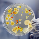 Gloved Hand Holding Petri Dish with Bacteria Culture
