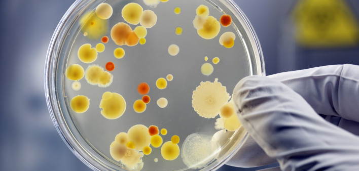Gloved Hand Holding Petri Dish with Bacteria Culture