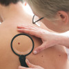 Skin cancer examination