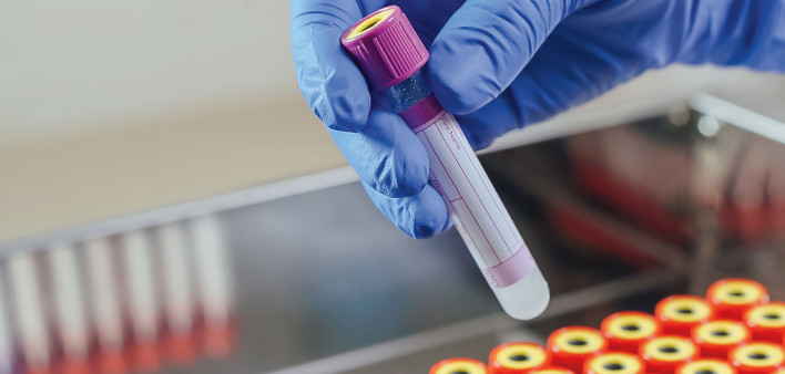 test tubes in laboratory