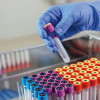 test tubes in laboratory