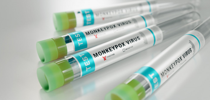 monkeypox virus