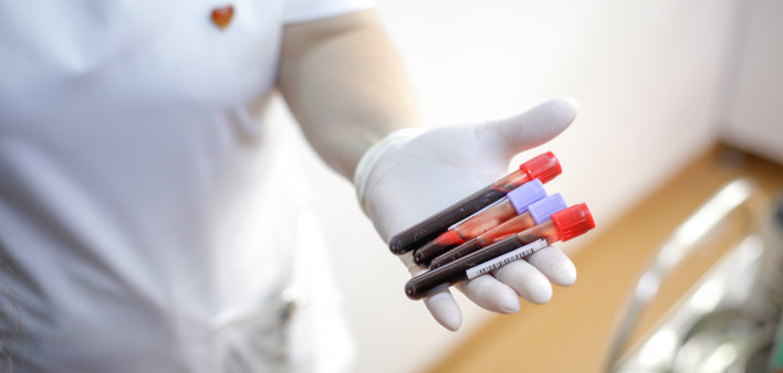 female medical worker holding blood vials after a blood donation