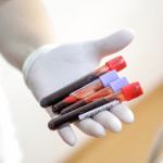 female medical worker holding blood vials after a blood donation