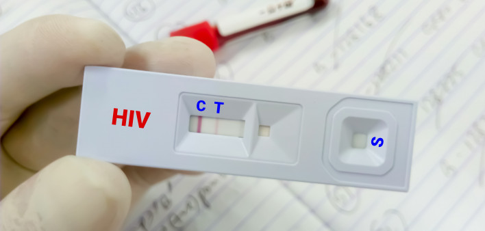 Rapid screening test for HIV (human immunodeficiency virus) screening test. Technician hold rapid test cassette,